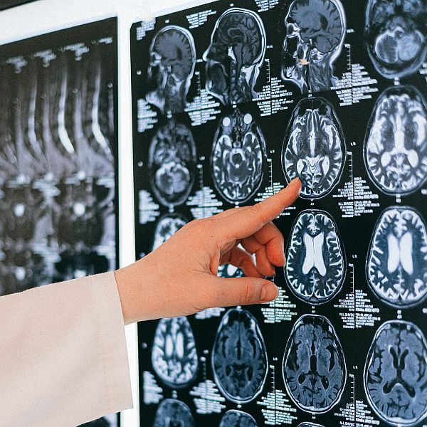 UK Concussion Guidelines for Non-Elite (Grassroots) Sport